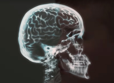 乔伊·马加德的大脑映射图