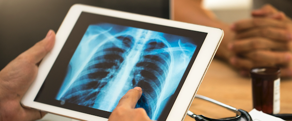 平板电脑上肺部的x光照片。