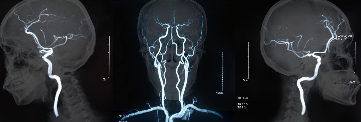 颅骨x光片的三张图。